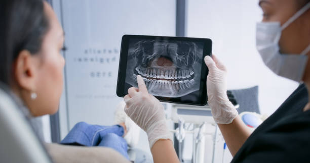 Licensed Wisdom Tooth Removal service in Chesterfield, MO - Smile Center Dentistry